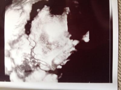 Bild zu Foto und Bericht 3. Screening - Forum für Januar - Mamis