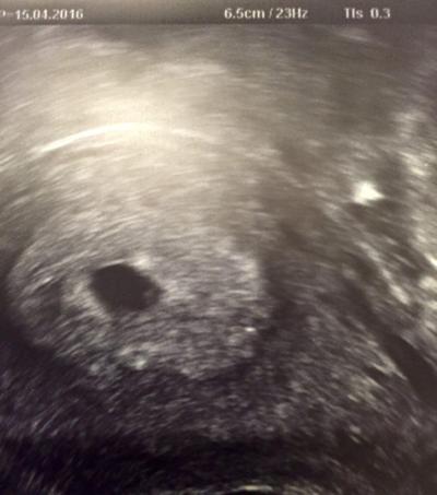 Bild zu Mal wieder was positives :-) - Forum für Januar - Mamis