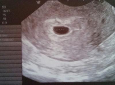 Bild zu Ich darf mich zu euch gesellen :) - Forum für Januar - Mamis