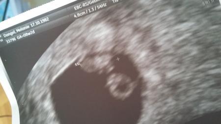 Bild zu Man erkennt endlich ein Baby < 3 - Forum für Januar - Mamis