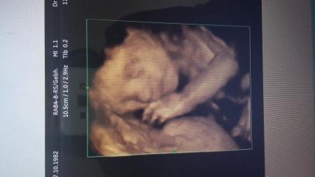 Bild zu Heute VU, Zuckertest und 3D - Forum für Januar - Mamis