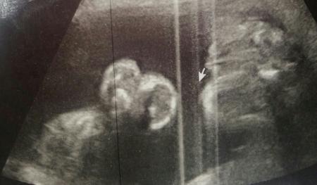 Bild zu 30. SSW Mädchen oder doch Junge?? Foto - Forum für Januar - Mamis