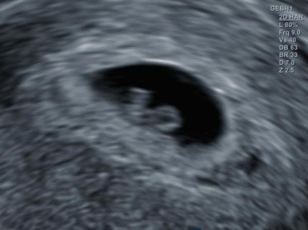 Bild zu Zurück vom DA und verliebt - Forum für Januar - Mamis