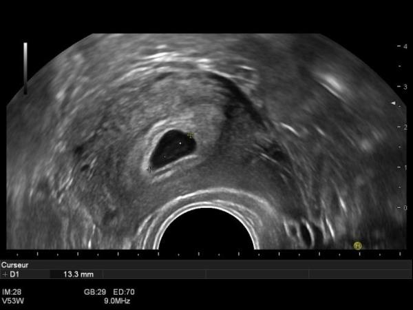 Bild zu 1. Ultraschall - Forum für Januar - Mamis