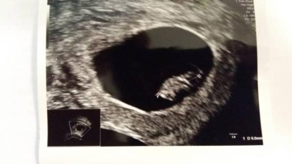 Bild zu 7+1 und alles ist gut - Forum für Januar - Mamis