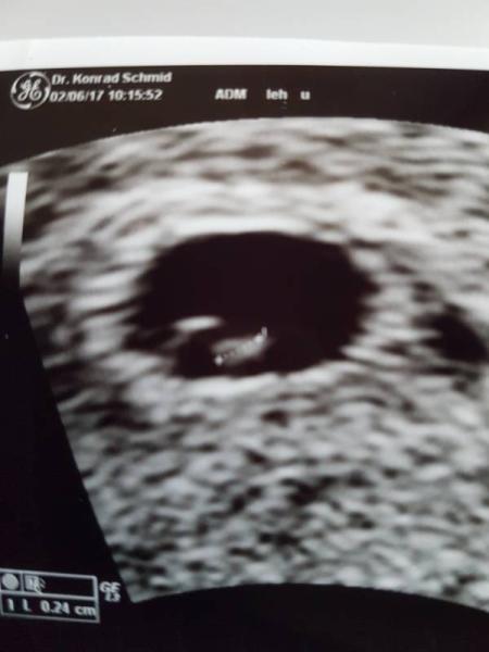 Bild zu Zurück vom FA. Happy und sauer - Forum für Januar - Mamis
