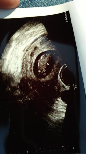 Bild zu Heute FA zur Kontrolle  - Forum für Januar - Mamis