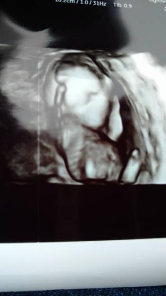 Bild zu Großer Ultraschall - Forum für Januar - Mamis