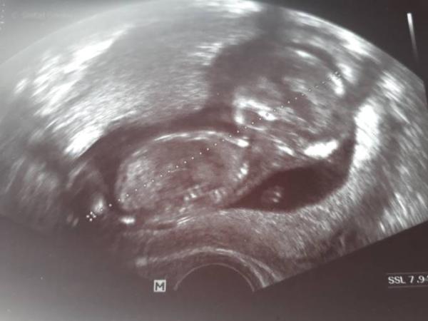 Bild zu FA Termin - Forum für Januar - Mamis