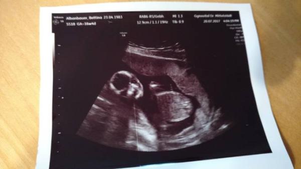 Bild zu Verstärkung für Team Rosa - Forum für Januar - Mamis