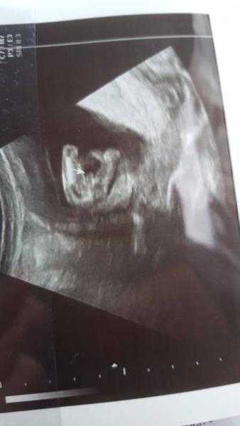 Bild zu Junge oder Mädchen? - Forum für Januar - Mamis