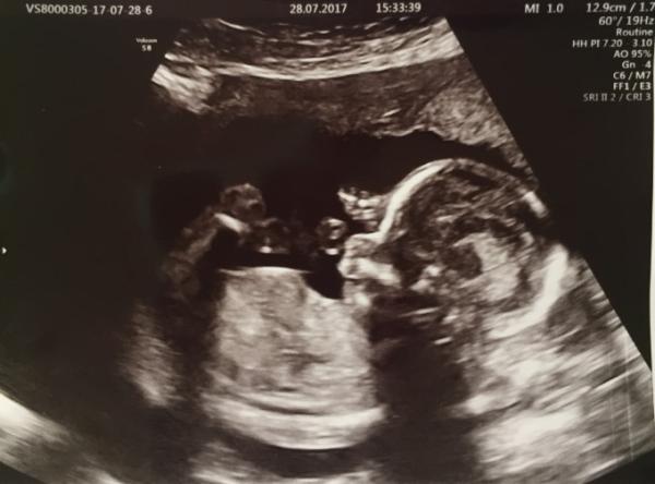 Bild zu Endlich !!! - Forum für Januar - Mamis