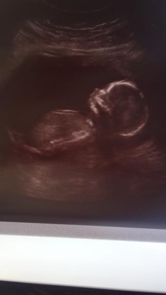 Bild zu Auch ich bin wieder zu Tränen gerührt < 3 - Forum für Januar - Mamis