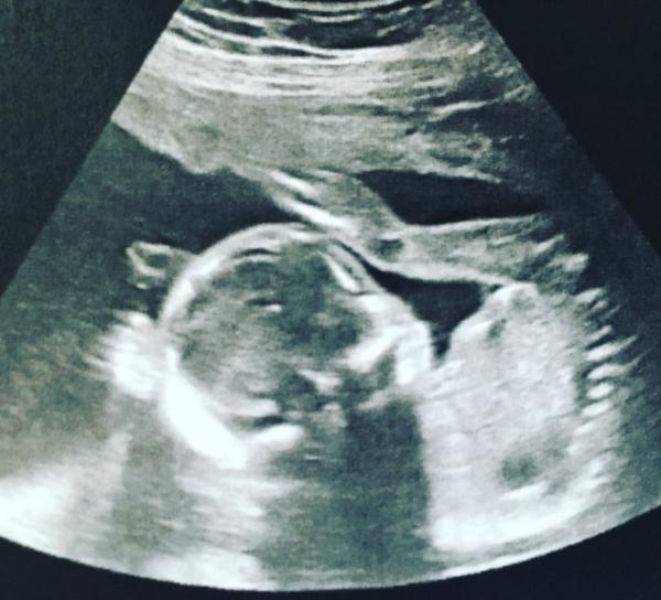Bild zu Endlich wieder Baby gucken... - Forum für Januar - Mamis