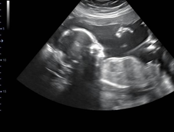 Bild zu Wieder da... - Forum für Januar - Mamis