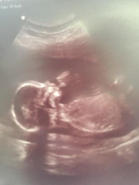 Bild zu FA Termin + sicheres outing! - Forum für Januar - Mamis