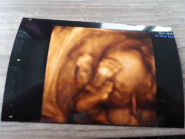Bild zu Heute 3D Ultraschall - Forum für Januar - Mamis