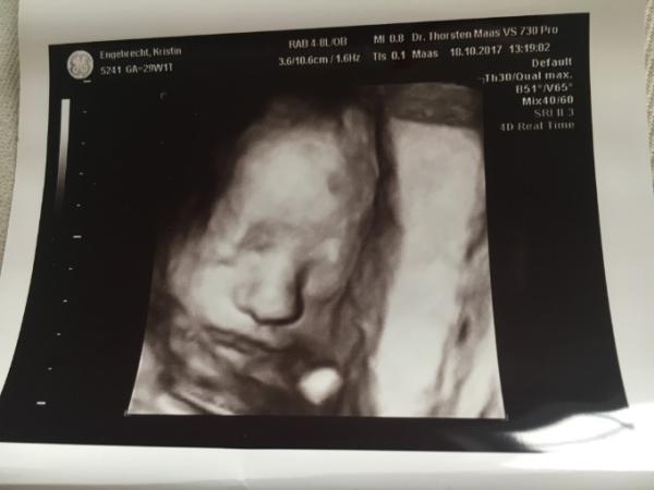 Bild zu Großes Ultraschall & morgen CTG - Forum für Januar - Mamis