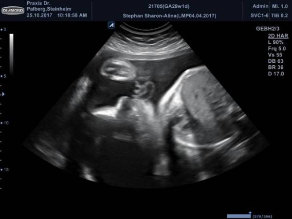 Bild zu Zurück vom Arzt Ultraschall und CTG - Forum für Januar - Mamis