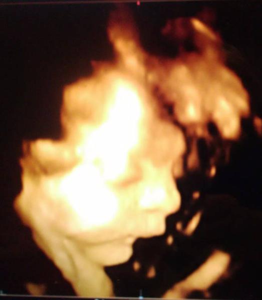 Bild zu 3 D Ultraschall - Forum für Januar - Mamis