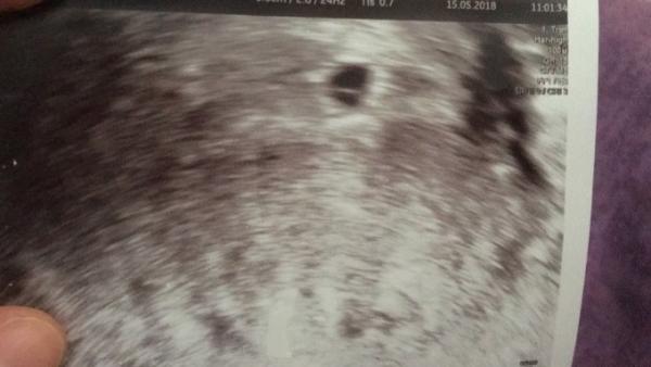 Bild zu Zurück vom FA - Forum für Januar - Mamis