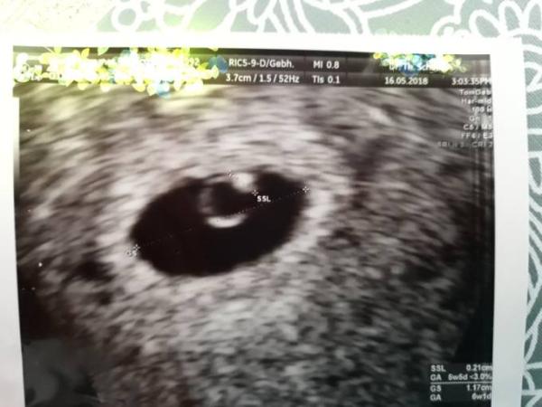 Bild zu Hatte heute leichte blutung aber... - Forum für Januar - Mamis