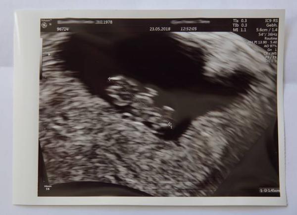 Bild zu 7+5 und alles wird hoffentlich gut. - Forum für Januar - Mamis