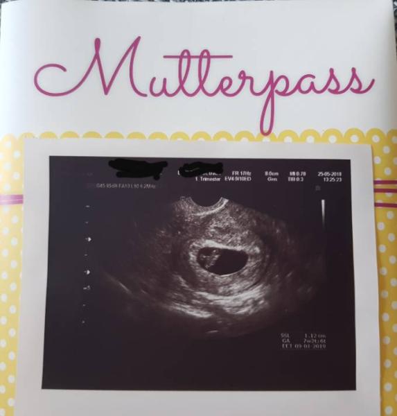 Bild zu Herzschlag...ist da 😍😍 - Forum für Januar - Mamis