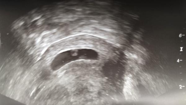 Bild zu Erster Fa Termin - Forum für Januar - Mamis