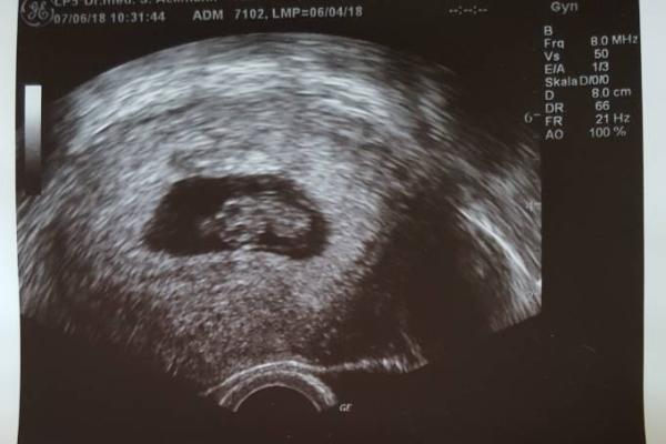 Bild zu Neuigkeiten vom Arzt - Forum für Januar - Mamis
