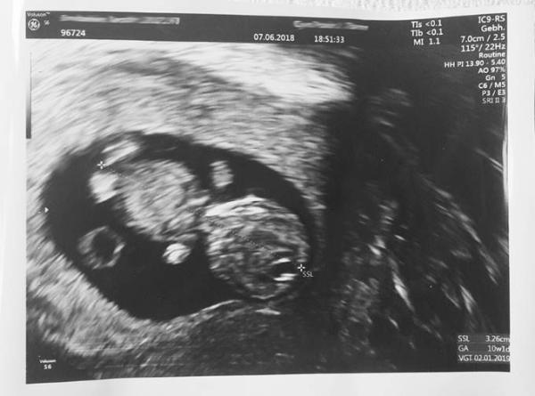 Bild zu Vordatiert und glücklich  - Forum für Januar - Mamis