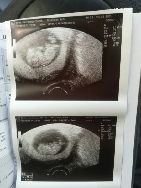 Bild zu Wieder beruigt - Forum für Januar - Mamis