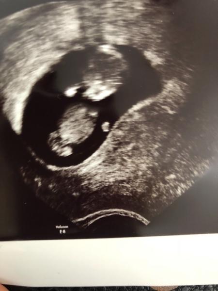 Bild zu Auch beim FA gewesen und vorsichtiges Hallo - Forum für Januar - Mamis