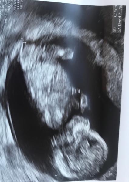 Bild zu 4 Wochen endlich wieder um - Forum für Januar - Mamis