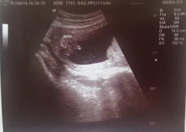 Bild zu FA Termin und Outing :) - Forum für Januar - Mamis