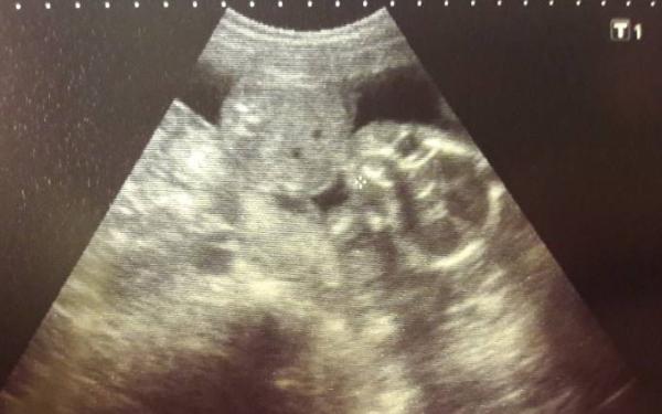 Bild zu FA Termin - Forum für Januar - Mamis