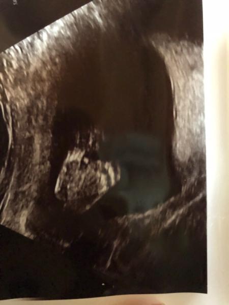 Bild zu It‘s a... - Forum für Januar - Mamis