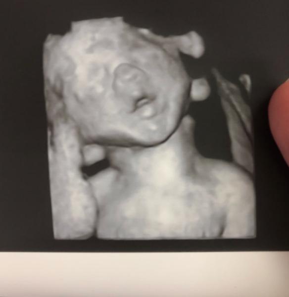 Bild zu 2. großer US und Fotos :)  - Forum für Januar - Mamis