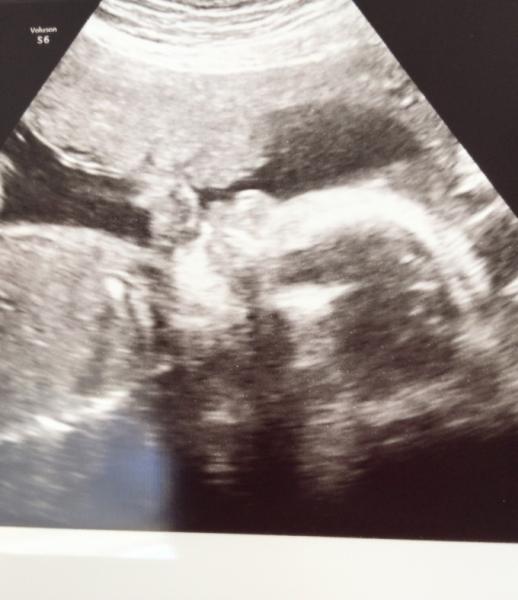Bild zu Hallo :) - Forum für Januar - Mamis