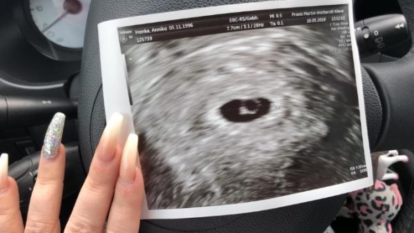 Bild zu FA Termin - Forum für Januar - Mamis