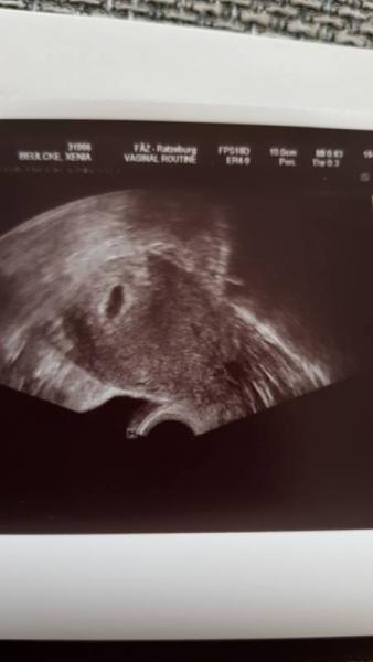 Bild zu Grade ersten FA Termin hinter mir - Forum für Januar - Mamis