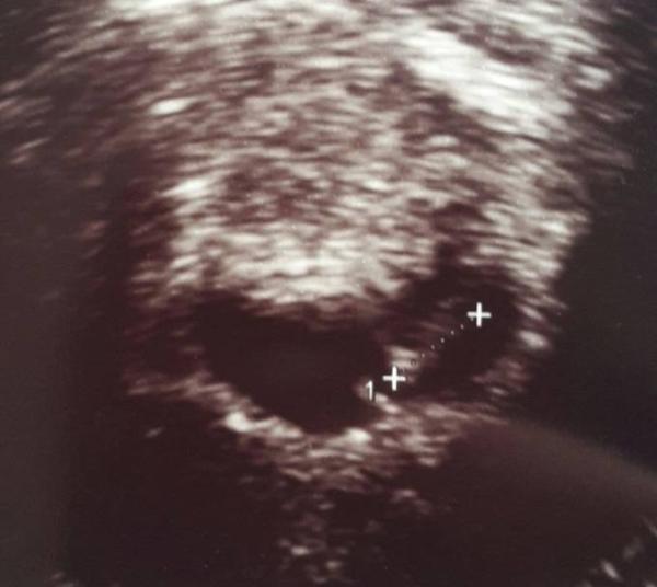 Bild zu Jetzt offiziell im Januarbus - Forum für Januar - Mamis