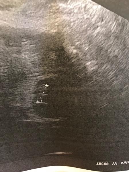 Bild zu Arzttermin - Forum für Januar - Mamis