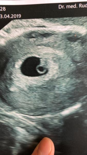 Bild zu Endlich :) - Forum für Januar - Mamis