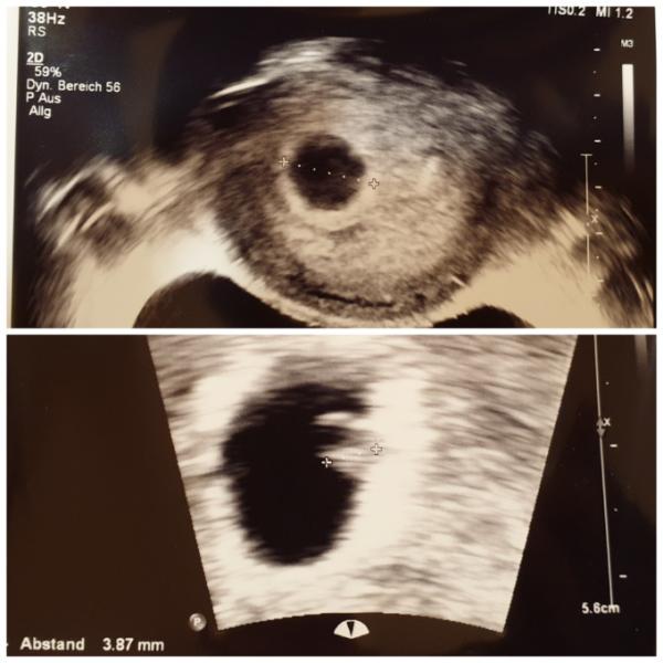 Bild zu 1. FA Termin :) - Forum für Januar - Mamis