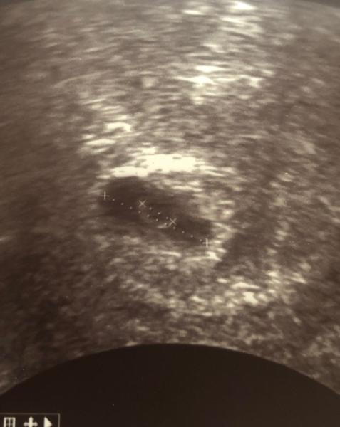 Bild zu Heute 2 Fa Termin ... - Forum für Januar - Mamis