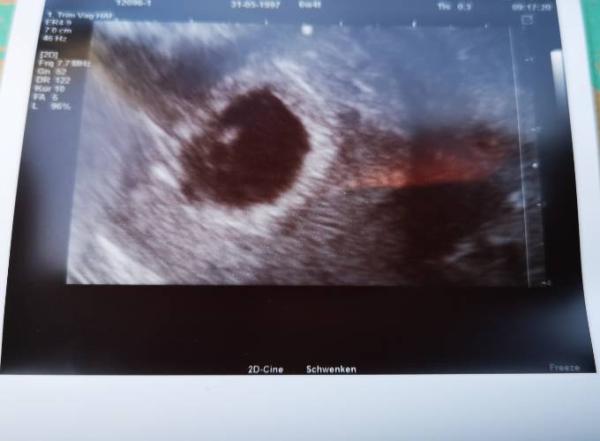 Bild zu 1. FA Termin... - Forum für Januar - Mamis