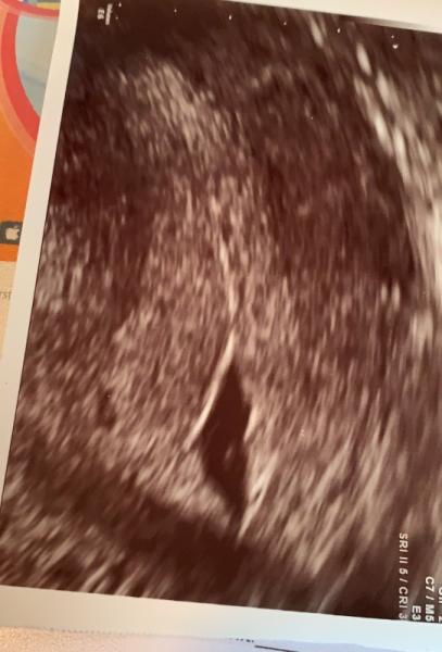 Bild zu Ziehen - Forum für Januar - Mamis