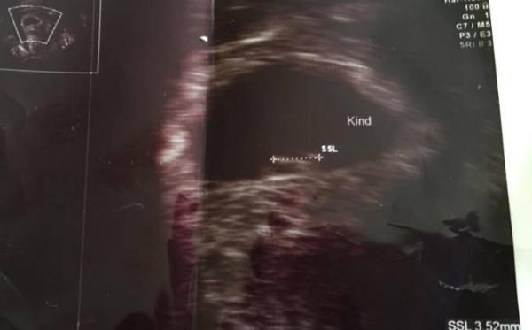 Bild zu Ich hab auch endlich ein Bild 😍 - Forum für Januar - Mamis