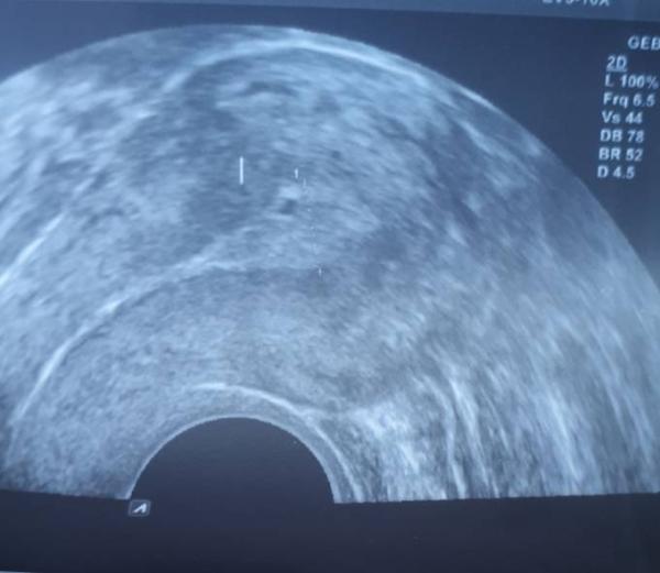 Bild zu Seit gestern Blutungen - Forum für Januar - Mamis